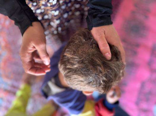 Skin disease due to lack of water