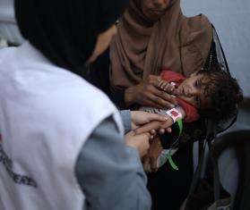 An MSF nurse examines 8-month-old Nour, who is severely malnourished.