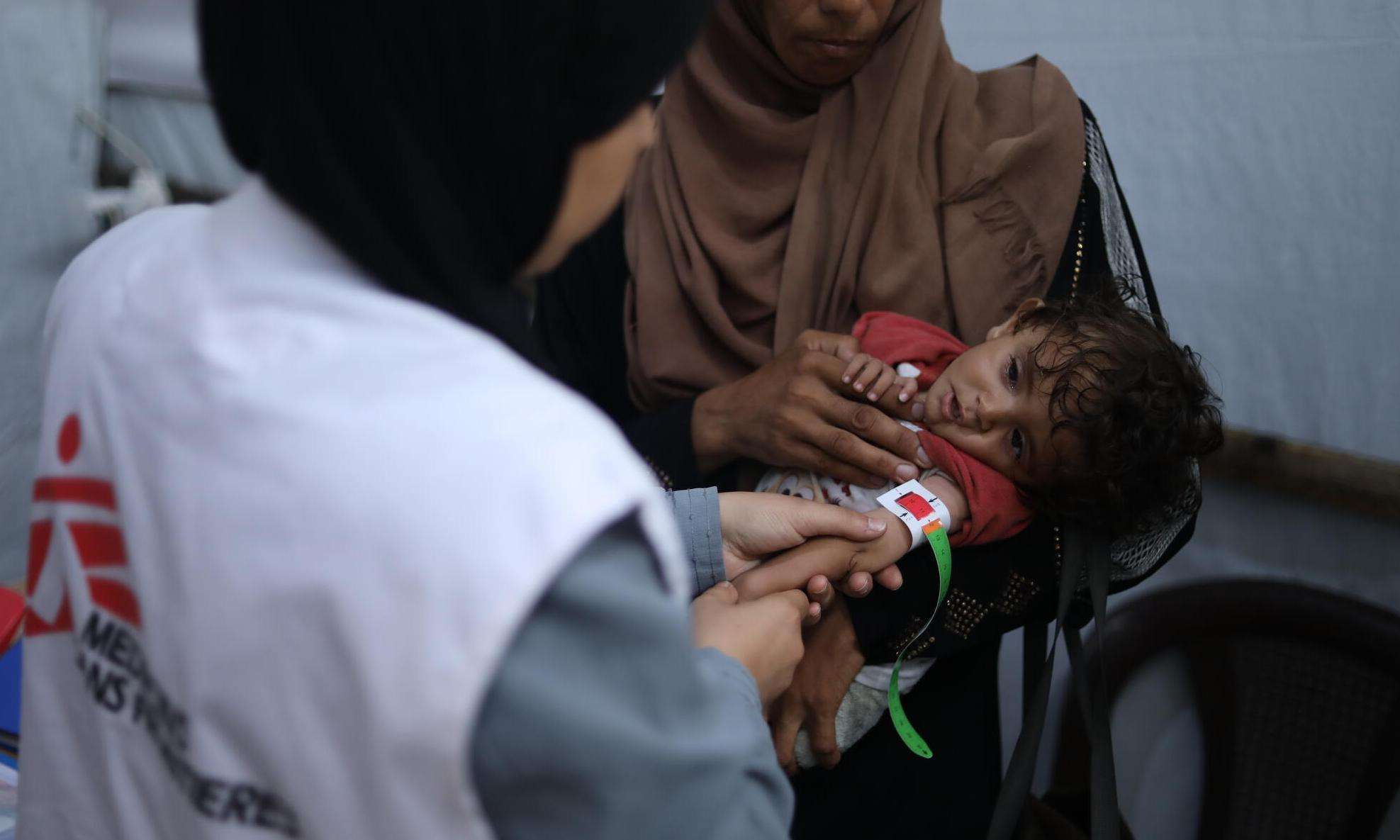 An MSF nurse examines 8-month-old Nour, who is severely malnourished.