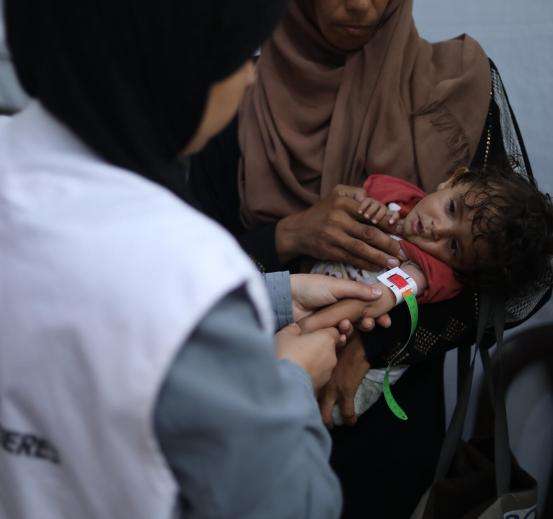 An MSF nurse examines 8-month-old Nour, who is severely malnourished.