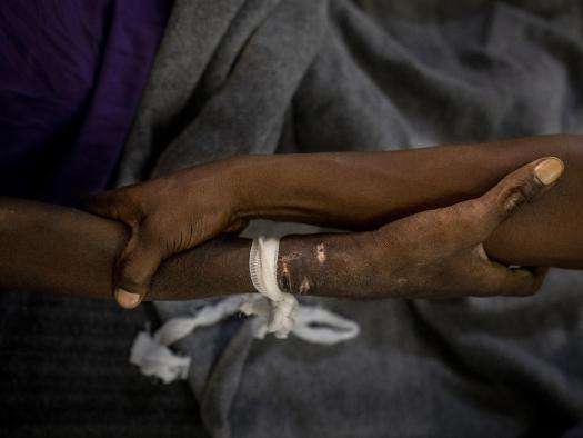 Advanced HIV in Kinshasa