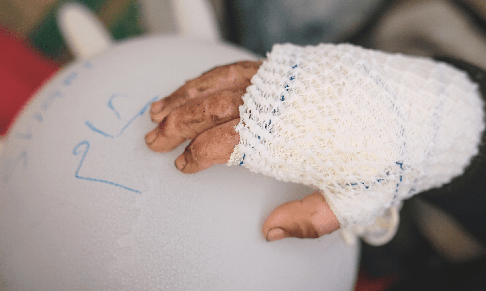 An injured child rests their hand on a balloon in Gaza.