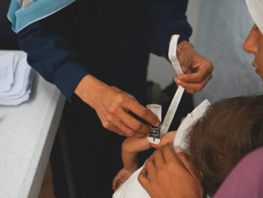 Teams measure a child's arm at MSF's clinic in Gaza City in June 2025. 