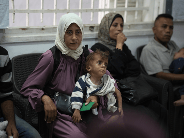 A mother and her malnourished child wait for care in Gaza.